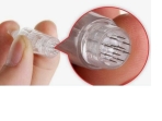 Tratamiento de vitaminas con microneedling